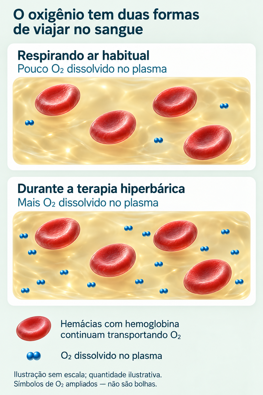 Ilustração educativa em 3D, gerada por IA: em condições habituais, há pouco oxigênio dissolvido no plasma; durante a terapia hiperbárica, essa parcela aumenta. As hemácias continuam transportando oxigênio nos dois quadros. Os símbolos de O₂ representam moléculas, não bolhas. Imagem sem escala e sem proporção quantitativa.